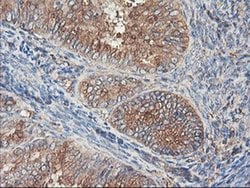 TUBAL3 Monoclonal Antibody (OTI1C2), TrueMAB , OriGene 30 &mu;L; Unconjugated:Antibodies,