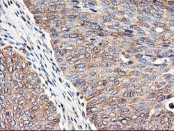 TUBAL3 Monoclonal Antibody (OTI1C2), TrueMAB , OriGene 30 &mu;L; Unconjugated:Antibodies,