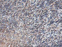 TUBAL3 Monoclonal Antibody (OTI1C2), TrueMAB , OriGene 30 &mu;L; Unconjugated:Antibodies,