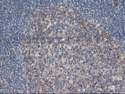 TUBAL3 Monoclonal Antibody (OTI1C2), TrueMAB , OriGene 30 &mu;L; Unconjugated:Antibodies,