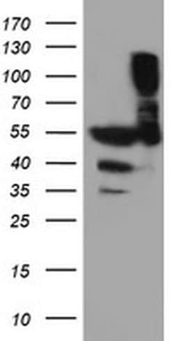 TUBAL3 Monoclonal Antibody (OTI5E4), TrueMAB , OriGene 30 &mu;L; Unconjugated:Antibodies,
