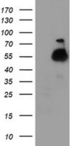 TUBAL3 Mouse anti-Human, Clone: OTI4D8, lyophilized, TrueMAB 100 &mu;g;