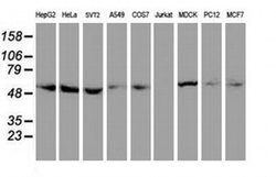 TUBAL3 Monoclonal Antibody (OTI4D9), TrueMAB , OriGene 100 &mu;L; Unconjugated:Antibodies,