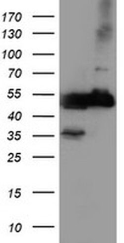 TUBAL3 Monoclonal Antibody (OTI5F10), TrueMAB , OriGene:Antibodies:Primary