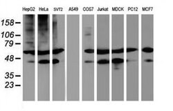TUBAL3 Monoclonal Antibody (OTI5F10), TrueMAB , OriGene:Antibodies:Primary
