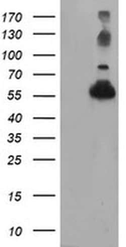 TUBAL3 Monoclonal Antibody (OTI2F6), TrueMAB , OriGene 30 &mu;L; Unconjugated:Antibodies,
