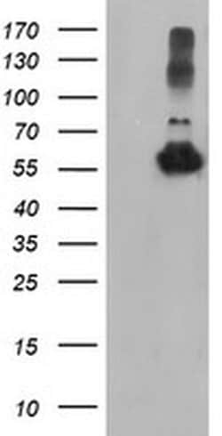TUBAL3 Monoclonal Antibody (OTI1C2), TrueMAB , OriGene 30 &mu;L; Unconjugated:Antibodies,