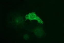 TUBB1 Monoclonal Antibody (OTI1D5), TrueMAB , OriGene:Antibodies:Primary