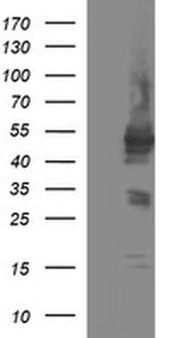 TUBB1 Monoclonal Antibody (OTI1D5), TrueMAB , OriGene:Antibodies:Primary