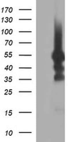 TUBB1 Monoclonal Antibody (OTI1G5), TrueMAB , OriGene 100 &mu;L | Buy Online | Origene Technologies | Fisher Scientific