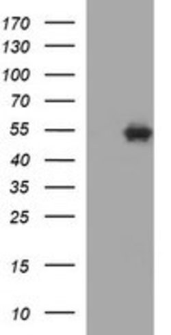 TUBB1 Mouse anti-Human, Clone: OTI1B9, lyophilized, TrueMAB 100 &mu;g;