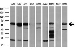 TUBB1 Monoclonal Antibody (OTI1B9), TrueMAB , OriGene:Antibodies:Primary