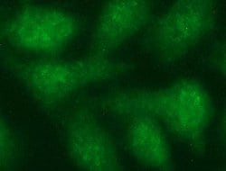 TUBB2A Monoclonal Antibody (OTI3B7), TrueMAB , OriGene 100 &mu;L; Unconjugated:Antibodies,