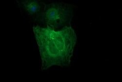 TUBB2A Monoclonal Antibody (OTI3E6), TrueMAB , OriGene 100 &mu;L; Unconjugated:Antibodies,