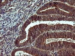 TUBB2A Monoclonal Antibody (OTI3E6), TrueMAB , OriGene 100 &mu;L; Unconjugated:Antibodies,