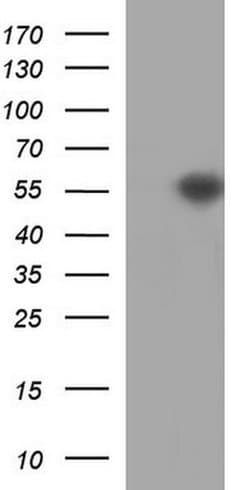TUBB2A Monoclonal Antibody (OTI3B7), TrueMAB , OriGene 100 &mu;L; Unconjugated:Antibodies,