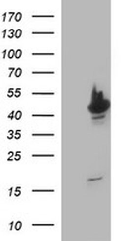 TUBB2A Monoclonal Antibody (OTI3E6), TrueMAB , OriGene 100 &mu;L; Unconjugated:Antibodies,