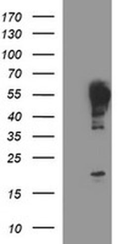 TUBB2A Monoclonal Antibody (OTI1H3), TrueMAB , OriGene 100 &mu;L; Unconjugated:Antibodies,