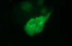 TUBB2B Monoclonal Antibody (OTI2H4), TrueMAB , OriGene:Antibodies:Primary