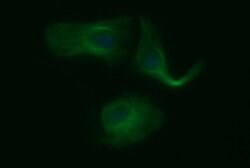 TUBB2B Monoclonal Antibody (OTI0C3), TrueMAB , OriGene 100 &mu;L; Unconjugated:Antibodies,