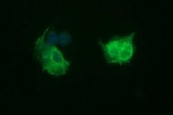 TUBB2B Monoclonal Antibody (OTI8F12), TrueMAB , OriGene 100 &mu;L; Unconjugated:Antibodies,