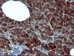 TUBB2B Monoclonal Antibody (OTI8F12), TrueMAB , OriGene 100 &mu;L; Unconjugated:Antibodies,