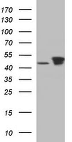 TUBB2B Monoclonal Antibody (OTI2H4), TrueMAB , OriGene 100 &mu;L; Unconjugated:Antibodies,