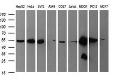 TUBB2B Monoclonal Antibody (OTI2H4), TrueMAB , OriGene 100 &mu;L; Unconjugated:Antibodies,