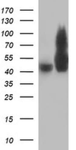 TUBB2B Monoclonal Antibody (OTI2G4), TrueMAB , OriGene:Antibodies:Primary