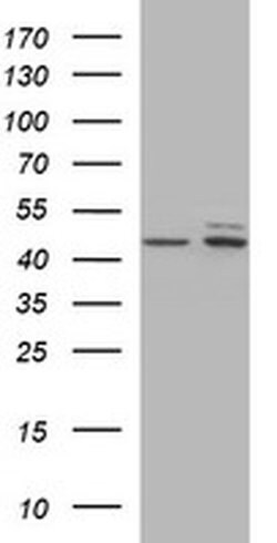 TUBB2B Monoclonal Antibody (OTI0C3), TrueMAB , OriGene 100 &mu;L; Unconjugated:Antibodies,