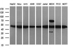 TUBB2B Monoclonal Antibody (OTI0C3), TrueMAB , OriGene 100 &mu;L; Unconjugated:Antibodies,