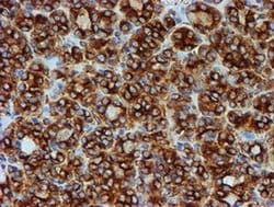 TUBB4 Mouse anti-Canine, Human, Mouse, Rat, Clone: OTI3F1, liquid, TrueMAB