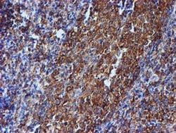 TUBB4 Mouse anti-Canine, Human, Mouse, Rat, Clone: OTI3F1, liquid, TrueMAB