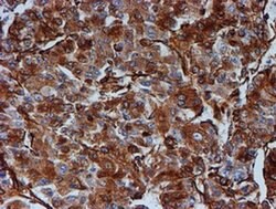 TUBB4 Mouse anti-Canine, Human, Mouse, Rat, Clone: OTI3F1, liquid, TrueMAB