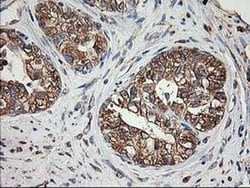 TUBB4 Monoclonal Antibody (OTI6C2), TrueMAB , OriGene 30 &mu;L; Unconjugated:Antibodies,