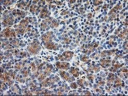TUBB4 Monoclonal Antibody (OTI6C2), TrueMAB , OriGene 30 &mu;L; Unconjugated:Antibodies,