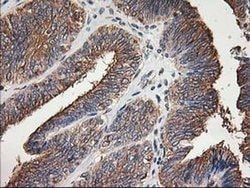 TUBB4 Monoclonal Antibody (OTI6C2), TrueMAB , OriGene 30 &mu;L; Unconjugated:Antibodies,