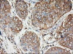TUBB4 Monoclonal Antibody (OTI6C2), TrueMAB , OriGene 30 &mu;L; Unconjugated:Antibodies,