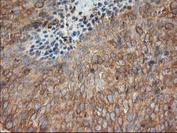 TUBB4 Monoclonal Antibody (OTI6C2), TrueMAB , OriGene 30 &mu;L; Unconjugated:Antibodies,