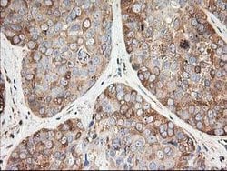 TUBB4 Mouse anti-Canine, Human, Mouse, Rat, Clone: OTI5C1, lyophilized,