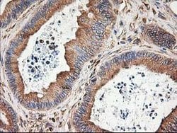 TUBB4 Mouse anti-Canine, Human, Mouse, Rat, Clone: OTI5C1, lyophilized,