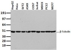 TUBB4 Mouse anti-Canine, Human, Mouse, Rat, Clone: OTI5C1, lyophilized,