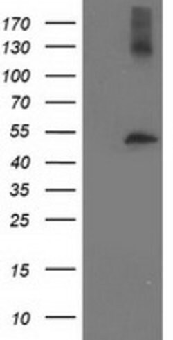 TUBB4 Mouse anti-Human, Clone: OTI6E3, lyophilized, TrueMAB 100 &mu;g | Buy Online | Origene Technologies | Fisher Scientific