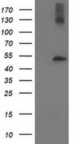 TUBB4 Mouse anti-Human, Clone: OTI6E3, liquid, TrueMAB 100 &mu;L; Unconjugated:Antibodies,