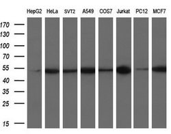 TUBB4 Mouse anti-Human, Clone: OTI6E3, lyophilized, TrueMAB 100 &mu;g | Buy Online | Origene Technologies | Fisher Scientific