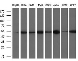 TUBB4 Mouse anti-Human, Clone: OTI6E3, liquid, TrueMAB 100 &mu;L; Unconjugated:Antibodies,