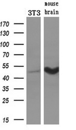 TUBB4 Mouse anti-Human, Clone: OTI6E3, lyophilized, TrueMAB 100 &mu;g | Buy Online | Origene Technologies | Fisher Scientific