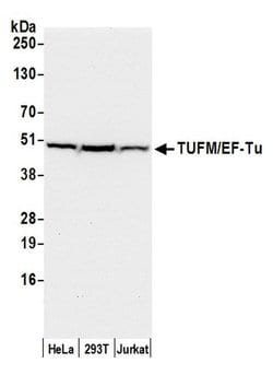 TUFM/EF-Tu Polyclonal Antibody, Bethyl Laboratories 20 &mu;L; Unconjugated:Antibodies,