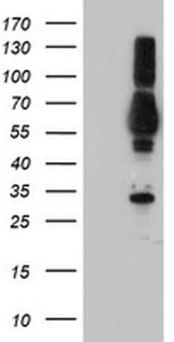 TULP3 Monoclonal Antibody (OTI6H4), TrueMAB , OriGene 30 &mu;L; Unconjugated:Antibodies,