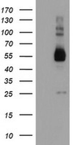 TULP3 Monoclonal Antibody (OTI7B8), TrueMAB , OriGene 30 &mu;L | Buy Online | Origene Technologies | Fisher Scientific